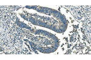 IHC analysis of IDH2 using anti-IDH2 antibody (ABIN7602786). (IDH2 anticorps  (C-Term))