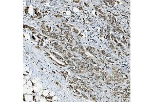 IHC analysis of RAB1B using anti-RAB1B antibody (ABIN7602809). (RAB1B anticorps  (C-Term))