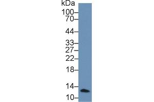 Detection of b2M in Human Leukocyte lysate using Polyclonal Antibody to Beta-2-Microglobulin (b2M)