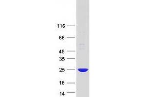 Validation with Western Blot