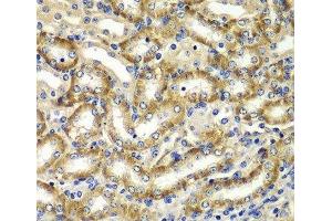 Immunohistochemistry of paraffin-embedded Mouse kidney using DGKE Polyclonal Antibody at dilution of 1:100 (40x lens). (DGKE anticorps)