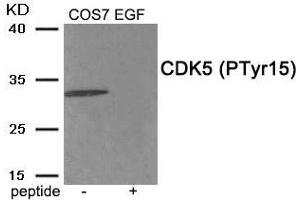 Western blot analysis of extracts from COS7 cells treated with EGF using Phospho-CDK5 (Tyr15) antibody. (CDK5 anticorps  (pTyr15))