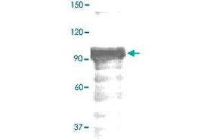 The whole tissue lysate derived from mouse kidney was immunoblotted by STAT4 (phospho Y693) polyclonal antibody  at 1 : 500. (STAT4 anticorps  (pTyr693))