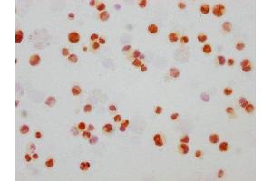 Immunocytochemistry analysis of ABIN7127709 diluted at 1:165 and staining in Hela cells(treated with 100 ng/mL EGF for 4h) performed on a Leica BondTM system. (Recombinant JNK anticorps  (pThr183, pThr221))