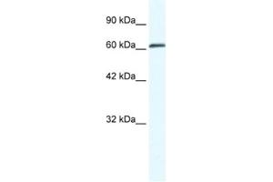 Western Blotting (WB) image for anti-Zinc Finger, MYM-Type 6 (ZMYM6) antibody (ABIN2461062)