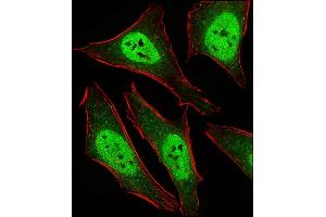 Fluorescent ige of Hela cells stained with D2L2 Antibody (C-term) (ABIN6243877 and ABIN6577436). (MAD2L2 anticorps  (C-Term))
