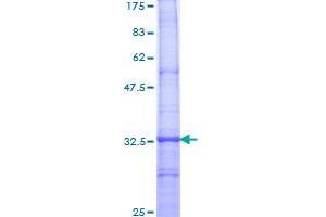 Image no. 1 for Transient Receptor Potential Cation Channel, Subfamily C, Member 1 (TRPC1) (AA 442-505) protein (GST tag) (ABIN1323816)