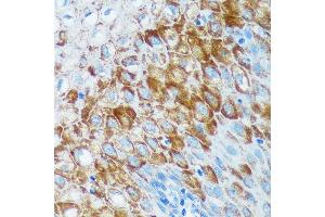 Immunohistochemistry of paraffin-embedded Human esophageal using IER5 Rabbit pAb (ABIN7267843) at dilution of 1:100 (40x lens). (IER5 anticorps)