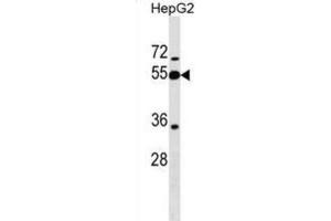 Western Blotting (WB) image for anti-Peptidase Inhibitor 16 (PI16) antibody (ABIN2999664) (PI16 anticorps)