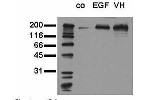 Phosphospecificity: Whole cell extracts of control (co), EGF stimulated (EGF) or pervanadate treated (VH) A549 tumor cells were applied to SDS-PAGE (20,000 cells per lane) and transferred to a PVDF membrane. (EGFR anticorps  (pTyr1173))
