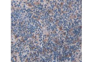 IHC-P analysis of Kidney tissue, with DAB staining. (ADRBK2 anticorps  (AA 191-453))