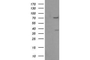 Image no. 6 for anti-Fragile X Mental Retardation 1 (FMR1) antibody (ABIN1498287)