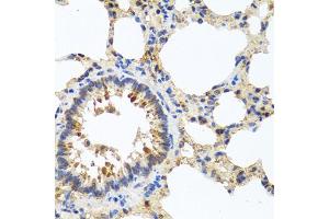 Immunohistochemistry of paraffin-embedded rat lung using LRG1 antibody.