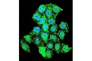 Confocal immunofluorescent analysis of ZMYND17 Antibody (C-term) (ABIN655547 and ABIN2845056) with Hela cell followed by Alexa Fluor 488-conjugated goat anti-rabbit lgG (green). (ZMYND17 anticorps  (C-Term))
