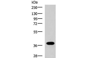 GPR6 anticorps