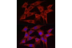 Immunofluorescence analysis of NIH/3T3 cells using INPP5K Rabbit pAb (ABIN6132112, ABIN6142473, ABIN6142474 and ABIN6223771) at dilution of 1:150 (40x lens).