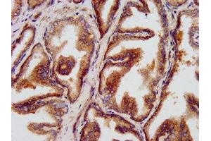 IHC image of ABIN7158026 diluted at 1:500 and staining in paraffin-embedded human prostate tissue performed on a Leica BondTM system.