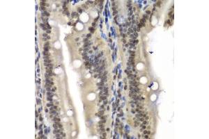 Immunohistochemistry of paraffin-embedded mouse Intestine using NELFE antibody (ABIN6289947) at dilution of 1:100 (40x lens).