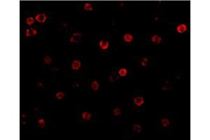 Immunofluorescence of CDH13 in K-562 cells with CDH13 polyclonal antibody  at 20 ug/mL . (Cadherin 13 anticorps  (N-Term))
