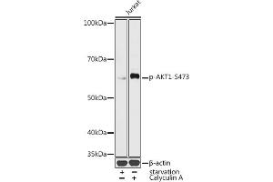 Western blot analysis of extracts of Jurka cells, using Phospho--S473 antibody (ABIN3019619, ABIN3019620, ABIN3019621 and ABIN1681366) at 1:1000 dilution. (AKT1 anticorps  (pSer473))