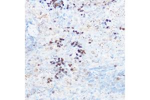 Immunohistochemistry of paraffin-embedded rat spleen using RUNX2 Rabbit pAb (ABIN3016833, ABIN3016834, ABIN3016835 and ABIN6219851) at dilution of 1:300 (40x lens).