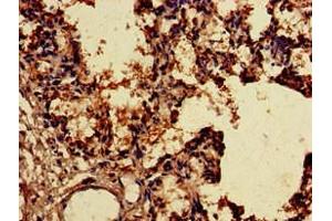 Immunohistochemistry of paraffin-embedded human lung tissue using ABIN7170356 at dilution of 1:100 (SNX15 anticorps  (AA 144-321))