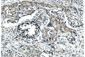 IHC analysis of Calponin 2/CNN2 using anti-Calponin 2/CNN2 antibody (ABIN7602856). (CNN2 anticorps  (C-Term))