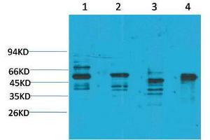 Western Blot (WB) analysis of 1) Rat Brain Tissue, 2)Mouse Brain Tissue, 3) K562, 4) HepG2 with KCNN4(SK4) Rabbit Polyclonal Antibody diluted at 1:2000. (KCNN4 anticorps)