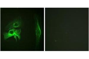 Immunofluorescence analysis of HeLa cells, using PAK1 (Ab-212) Antibody. (PAK1 anticorps  (AA 178-227))