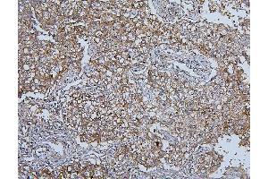 IHC analysis of HSPH1 using anti-HSPH1 antibody (ABIN7602237). (HSPH1 anticorps  (AA 653-858))