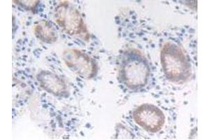 IHC-P analysis of Human Stomach Tissue, with DAB staining. (FGFRL1 anticorps  (AA 168-378))