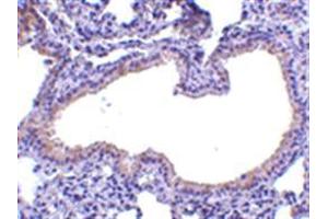Image no. 2 for anti-Secretory Leukocyte Peptidase Inhibitor (SLPI) (Middle Region) antibody (ABIN318889)