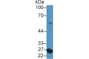 Western Blot; Sample: Rat Serum; Primary Ab: 1µg/ml Rabbit Anti-Rat NFIX Antibody Second Ab: 0. (NFIX anticorps  (AA 13-298))