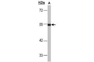 WB Image Sample(30 μg of whole cell lysate) A:293T 10% SDS PAGE antibody diluted at 1:1000 (DLD anticorps)