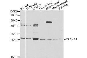 Western blot analysis of extracts of various cell lines, using CAPNS1 Antibody. (Calpain S1 anticorps  (AA 69-268))