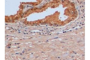 Detection of IDH1 in Human Prostate Tissue using Polyclonal Antibody to Isocitrate Dehydrogenase 1, Soluble (IDH1) (IDH1 anticorps  (AA 74-333))