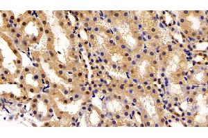 Detection of TKT in Rat Kidney Tissue using Polyclonal Antibody to Transketolase (TKT)