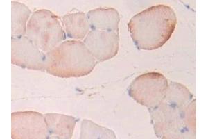Detection of PFKP in Rat Skeletal muscle Tissue using Polyclonal Antibody to Phosphofructokinase, Platelet (PFKP) (PFKP anticorps  (AA 354-570))