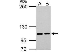 WB Image EPB41L3 antibody [C3], C-term detects EPB41L3 protein by Western blot analysis. (EPB41L3 anticorps  (C-Term))