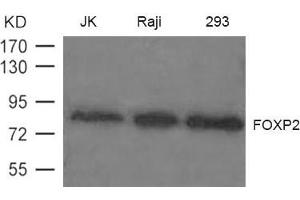 Western blot analysis of extract from JK, Raji and 293 cells using FOXP2 Antibody
