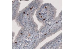 Immunohistochemical staining (Formalin-fixed paraffin-embedded sections) of human fallopian tube with CD8A monoclonal antibody, clone CL1529  shows strong positivity in a subset of lymphoid cells. (CD8 alpha anticorps  (AA 64-147))