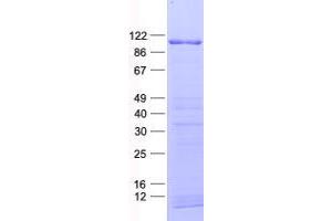 Validation with Western Blot