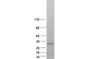 Validation with Western Blot