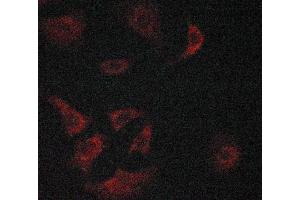 ABIN6268767 staining LOVO cells by ICC/IF.