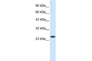 WB Suggested Anti-VPS24 Antibody Titration:  0. (CHMP3 anticorps  (N-Term))
