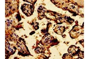Immunohistochemistry of paraffin-embedded human placenta tissue using ABIN7172906 at dilution of 1:100 (TPT1 anticorps  (AA 1-172))