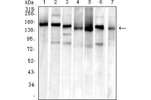 Western blot analysis using MSH6 mouse mAb against SH-SY5Y (1), Hela (2), PC-3 (3), HCT116 (4), HEK293 (5), A549 (6), and HepG2 (7) cell lysate. (MSH6 anticorps  (AA 374-540))