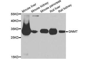 Western blot analysis of extracts of various cell lines, using GNMT antibody. (GNMT anticorps  (AA 1-295))