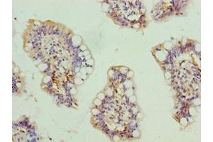 Immunohistochemistry of paraffin-embedded human small intestine tissue using ABIN7168606 at dilution of 1:100 (SCARA3 anticorps  (AA 201-466))