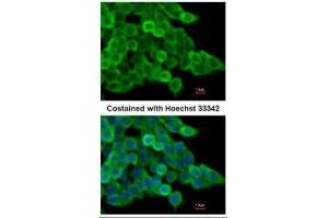 ICC/IF Image Immunofluorescence analysis of paraformaldehyde-fixed mouse ESC D3, using alpha Actin (smooth muscle), antibody at 1:200 dilution.